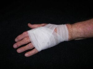 Hand Injuries